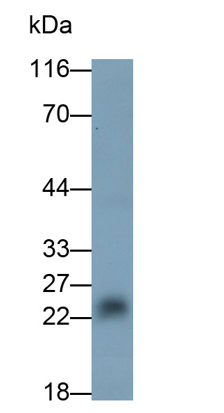 Polyclonal Antibody to Cathepsin L (CTSL)