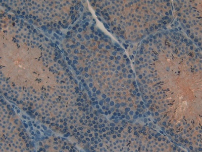 Polyclonal Antibody to Myosin IA (MYO1A)