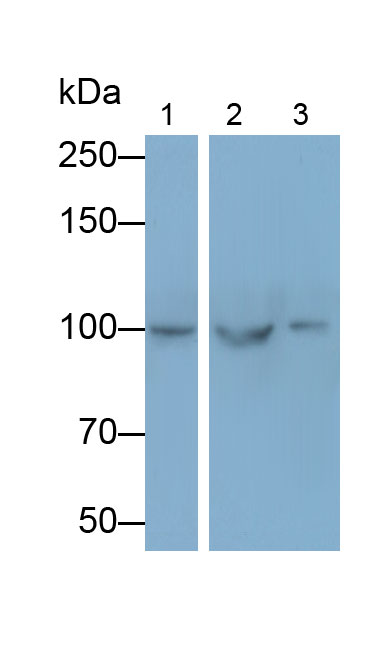 Polyclonal Antibody to Actinin Alpha 2 (ACTN2)