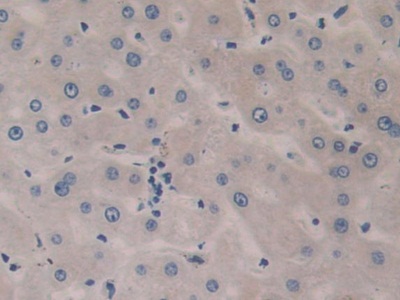 Polyclonal Antibody to Sex Hormone Binding Globulin (SHBG)
