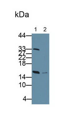 Polyclonal Antibody to Retinol Binding Protein 1, Cellular (RBP1)