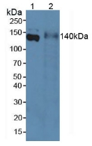 Polyclonal Antibody to Elastin Microfibril Interface Located Protein 1 (EMILIN1)