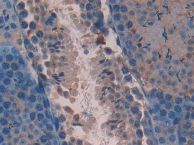 Polyclonal Antibody to Apoptosis Associated Tyrosine Kinase (AATK)