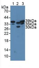 Polyclonal Antibody to Sirtuin 2 (SIRT2)