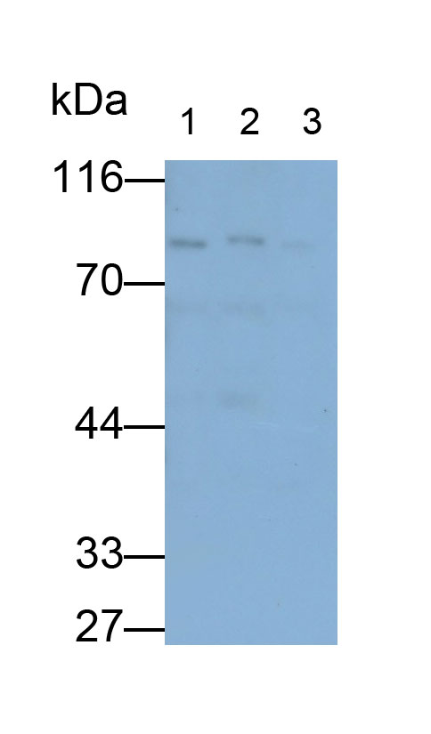 Polyclonal Antibody to Protein Kinase C Epsilon (PKCe)
