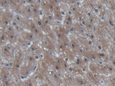 Polyclonal Antibody to N-Terminal Pro-Brain Natriuretic Peptide (NT-ProBNP)