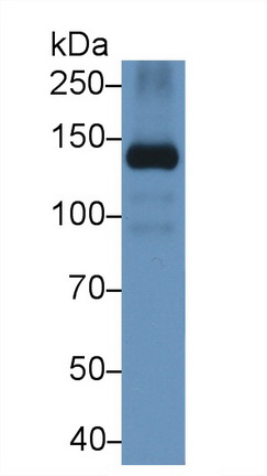 Polyclonal Antibody to D-Dimer (D2D)