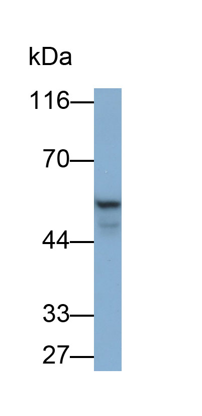 Polyclonal Antibody to Cytokeratin 7 (CK7)