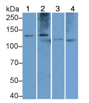 Polyclonal Antibody to Procollagen I C-Terminal Propeptide (PICP)