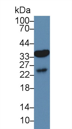 Polyclonal Antibody to Aquaporin 9 (AQP9)