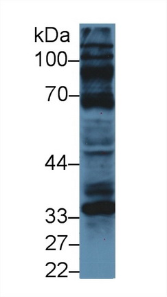 Polyclonal Antibody to Cyclin D1 (CCND1)