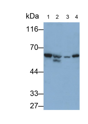 Polyclonal Antibody to Pyruvate kinase isozymes M2 (PKM2)