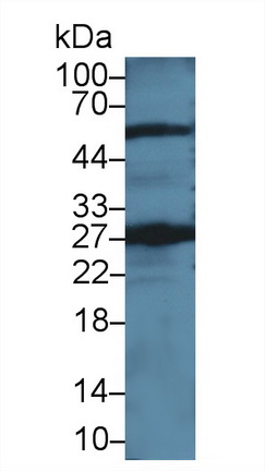 Polyclonal Antibody to Glutathione S Transferase Theta 2 (GSTt2)