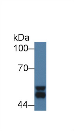 Polyclonal Antibody to Glycogen Synthase Kinase 3 Alpha (GSK3a)