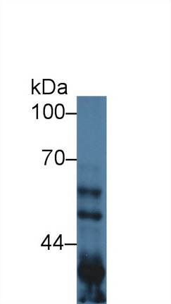 Polyclonal Antibody to Glycogen Synthase Kinase 3 Alpha (GSK3a)