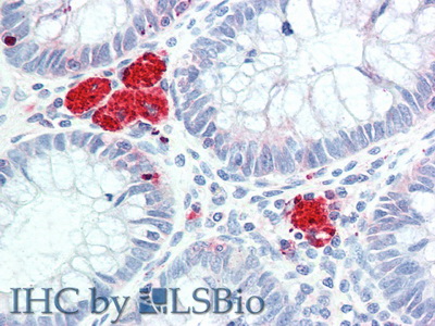 Polyclonal Antibody to Hexosaminidase B Beta (HEXb)