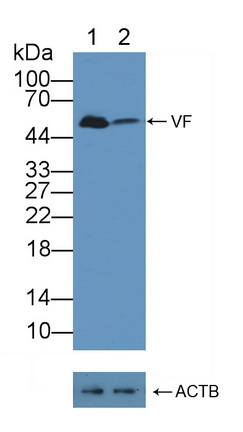 Polyclonal Antibody to Visfatin (VF)
