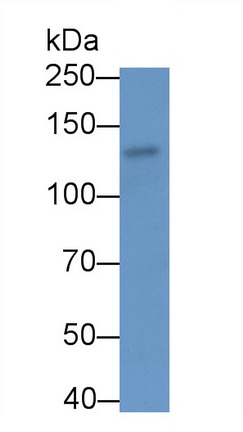 Polyclonal Antibody to Cross Linked N-Telopeptide Of Type I Collagen (NTXI)