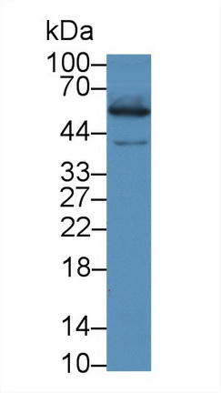 Polyclonal Antibody to Thioredoxin Reductase 1 (TXNRD1)