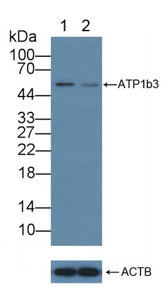 Polyclonal Antibody to Sodium/potassium Transporting ATPase Subunit Beta-3 (ATP1b3)
