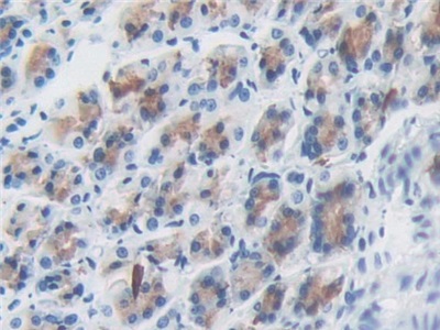 Polyclonal Antibody to Stromal Cell Derived Factor 4 (SDF4)