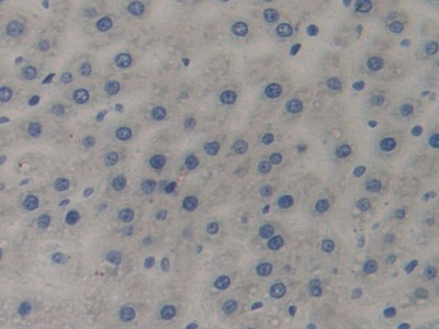 Polyclonal Antibody to Complement Component 7 (C7)