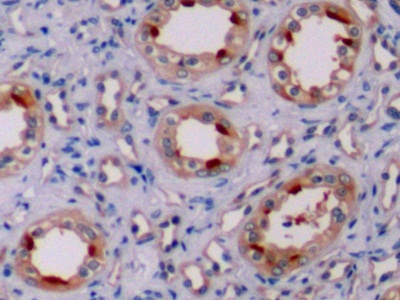 Polyclonal Antibody to B-Cell Leukemia/Lymphoma 2 (Bcl2)