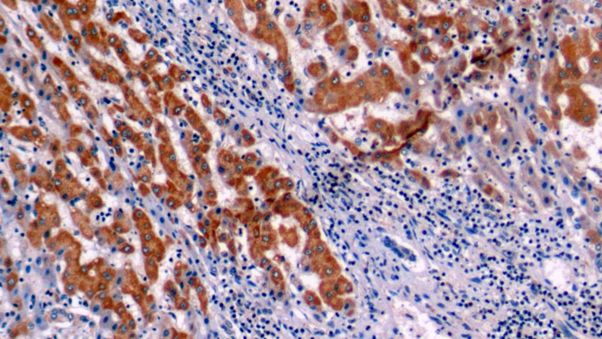 Polyclonal Antibody to B-Cell Leukemia/Lymphoma 2 (Bcl2)