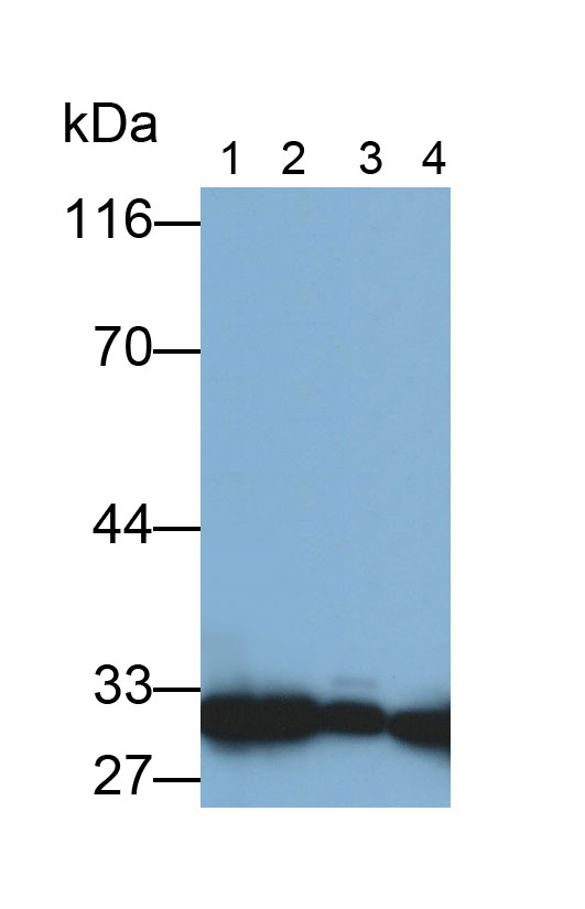 Polyclonal Antibody to Carbonic Anhydrase II (CA2)