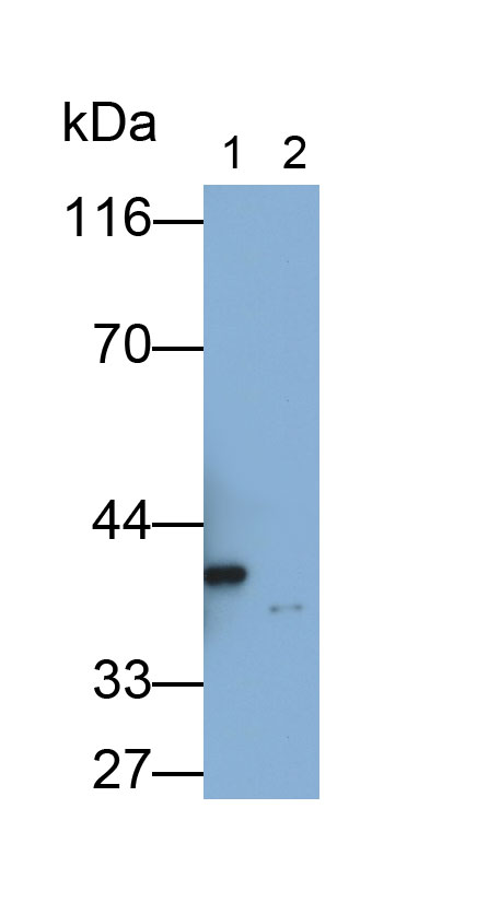 Polyclonal Antibody to Ficolin 1 (FCN1)