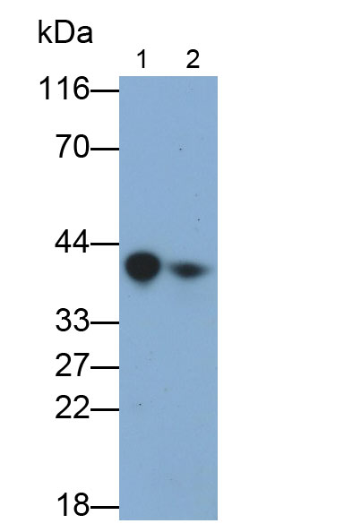 Polyclonal Antibody to Ficolin 1 (FCN1)