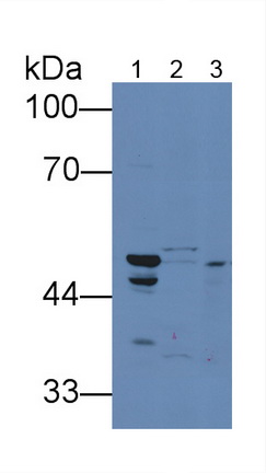 Polyclonal Antibody to Death receptor 5 (DR5)