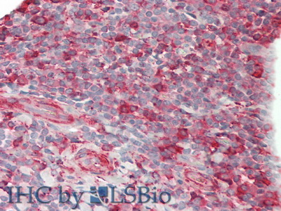 Polyclonal Antibody to Cluster Of Differentiation 86 (CD86)