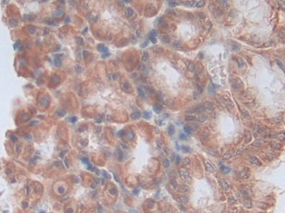Polyclonal Antibody to Tumor Necrosis Factor Ligand Superfamily, Member 14 (TNFSF14)