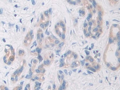 Polyclonal Antibody to Glycogen Phosphorylase, Brain (PYGB)