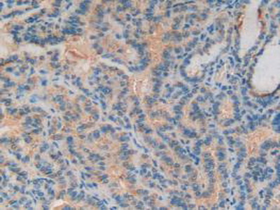 Polyclonal Antibody to Complement Component 3 (C3)