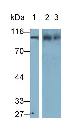 Polyclonal Antibody to Complement Component 2 (C2)