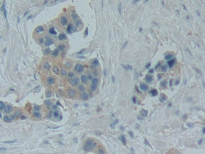 Polyclonal Antibody to Bradykinin (BK)