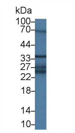 Polyclonal Antibody to Cluster Of Differentiation 58 (CD58)