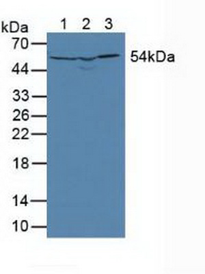 Polyclonal Antibody to Dihydrolipoyl Dehydrogenase (DLD)