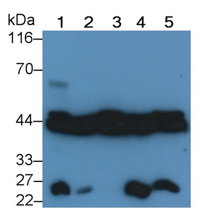 Polyclonal Antibody to Extracellular Signal Regulated Kinase 2 (ERK2)