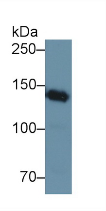 Polyclonal Antibody to Nephrin (NPHN)