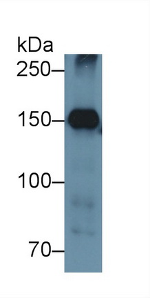 Polyclonal Antibody to Nephrin (NPHN)