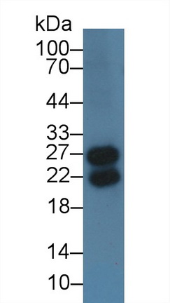 Polyclonal Antibody to Immunoglobulin Lambda Like Polypeptide 1 (IglL1)