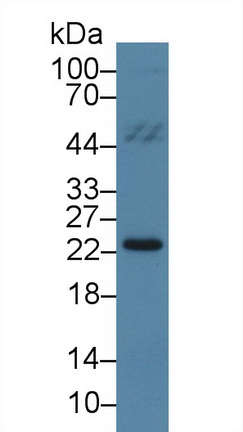Polyclonal Antibody to Pre-B-Lymphocyte Gene 1 (VPREB1)