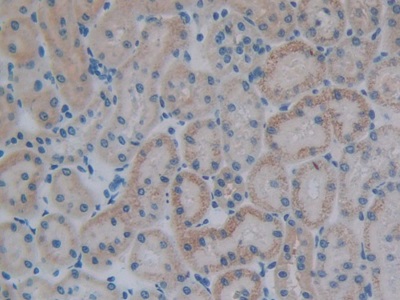 Polyclonal Antibody to Pre-B-Lymphocyte Gene 1 (VPREB1)