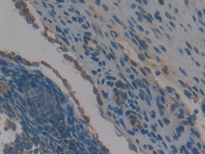 Polyclonal Antibody to Neutrophil Specific Antigen 1 (NB1)