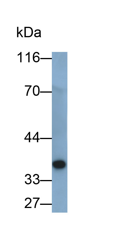 Polyclonal Antibody to Procollagen II C-Terminal Propeptide (PIICP)