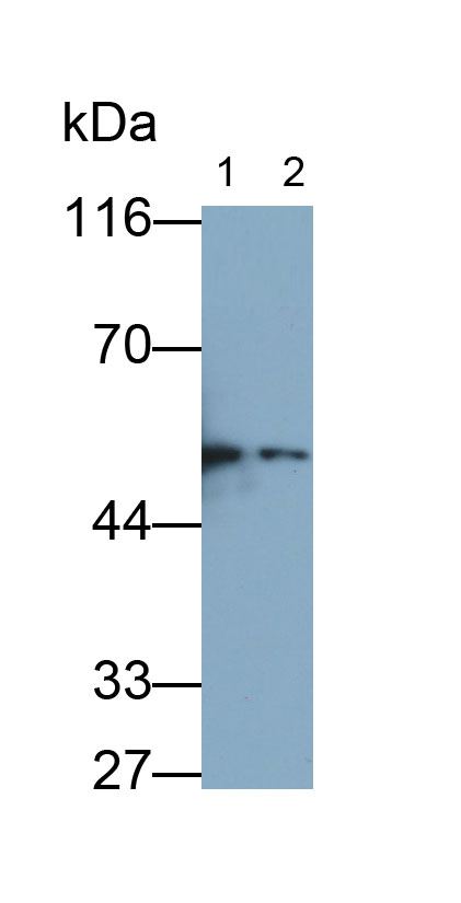 Polyclonal Antibody to Cholinergic Receptor, Muscarinic 1 (CHRM1)