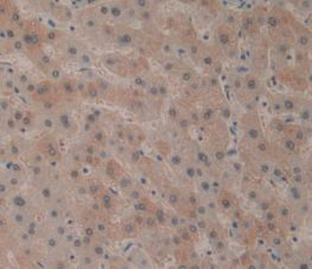 Polyclonal Antibody to Cluster Of Differentiation 161 (CD161)